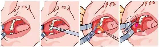 脂肪型|赵露思费劲巴拉才撕下大饼，秒被书粉喊退货，发布会生图确实让人出戏...