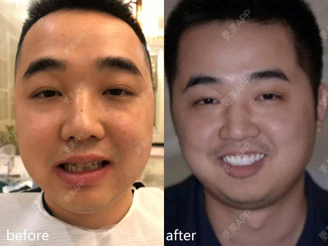 李沁|又一对顶流即将官宣？