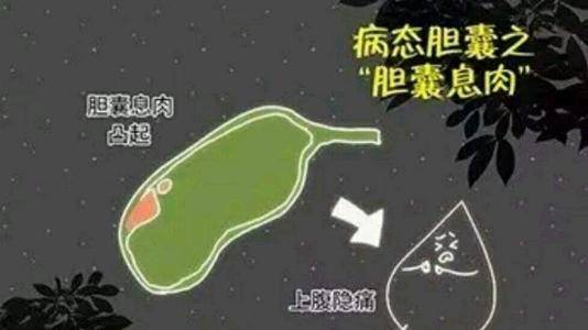 妇科检查有息肉怎么办