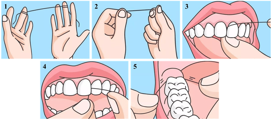 牙线科普丨不用牙线你的牙齿有一半永远是脏的