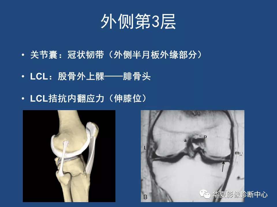 膝关节解剖详细图解