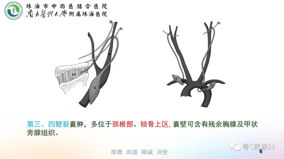 腮裂囊肿的ct表现知识总结!
