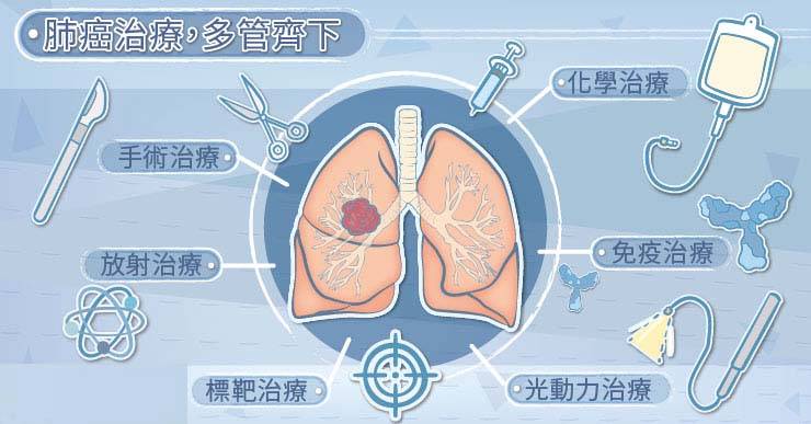 肺癌的治疗方法,肺癌的治疗选项有哪些?