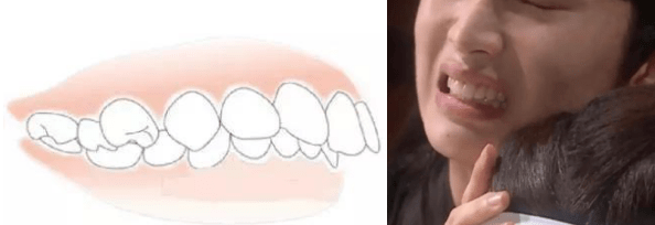 宋茜|苦练十年都翻不了身，什么样的表情管理方法才能拯救宋茜？