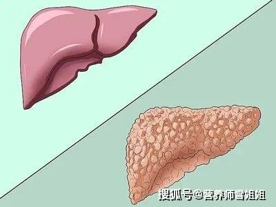 46岁男子,胸前有红点,查出肝硬化,提醒3类人,有异常早检查_手机搜狐网