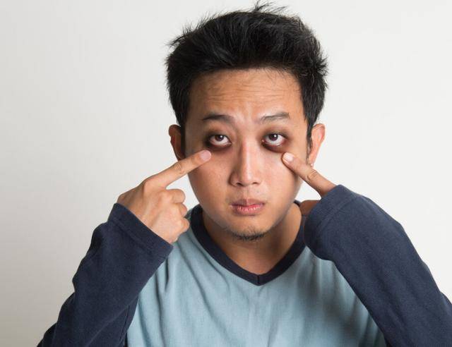 眼睛出现4种表现,别忽视,多半肝已"烂如渔网",请尽快自查