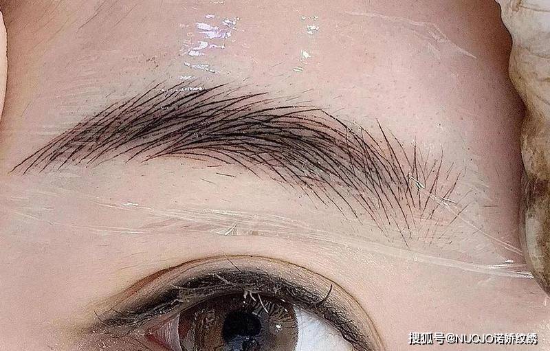 眉毛褪色 脱痂之后,痂皮会带走一部分色素,有的受术者在结痂脱落之后