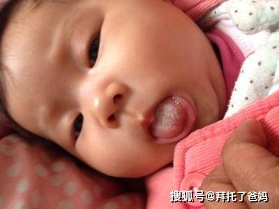 孩子|脸上发现3种迹象，脾胃已经不堪负重了孩子积食是拖出来的