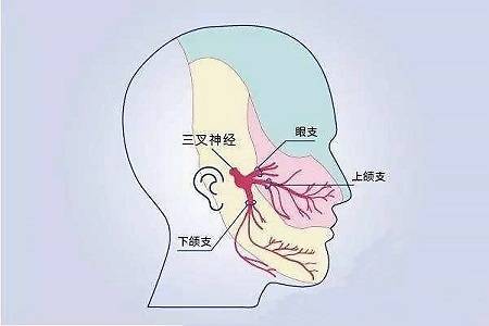 北京老中医吕红彬:三叉神经痛患者饮食和日常习惯注意
