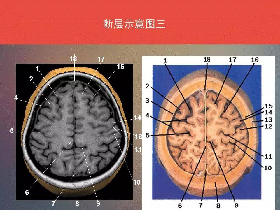 脑功能区及解剖学定位看到了你要记得收藏转发