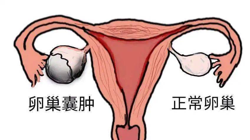 月经期乳腺刺痛怎么办