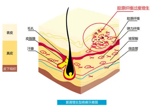 6d51156ed6a945d2bdd9fa77a8133e4e.png