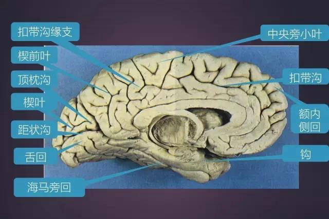 脑由灰质,白质,基底核和脑室等组成.
