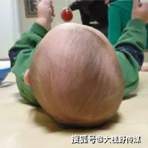 头颅|后果不堪设想！还在给宝宝睡头型？小心睡成头颅畸形