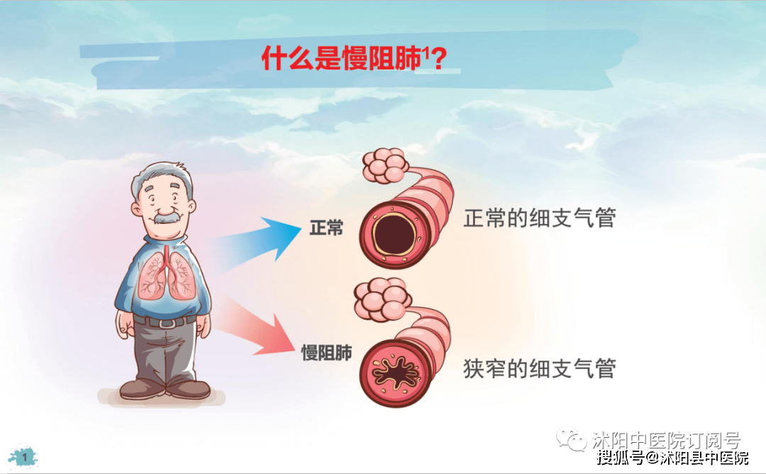 世界慢性阻塞性肺炎日"隐形杀手"慢阻肺可防可治可改善!