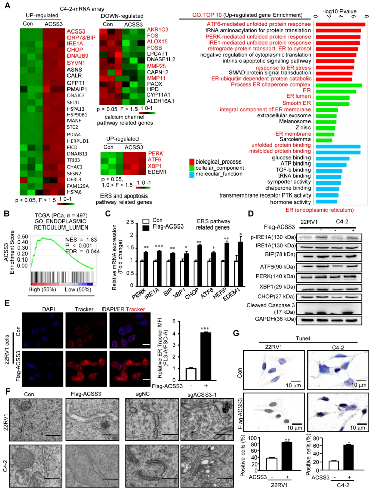 theranostics 欧易助力武汉协和医院发现前列腺癌抑制分子机制