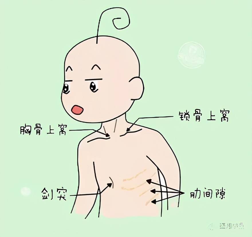 宝宝|13价肺炎疫苗给宝宝约了吗？肺炎高发期