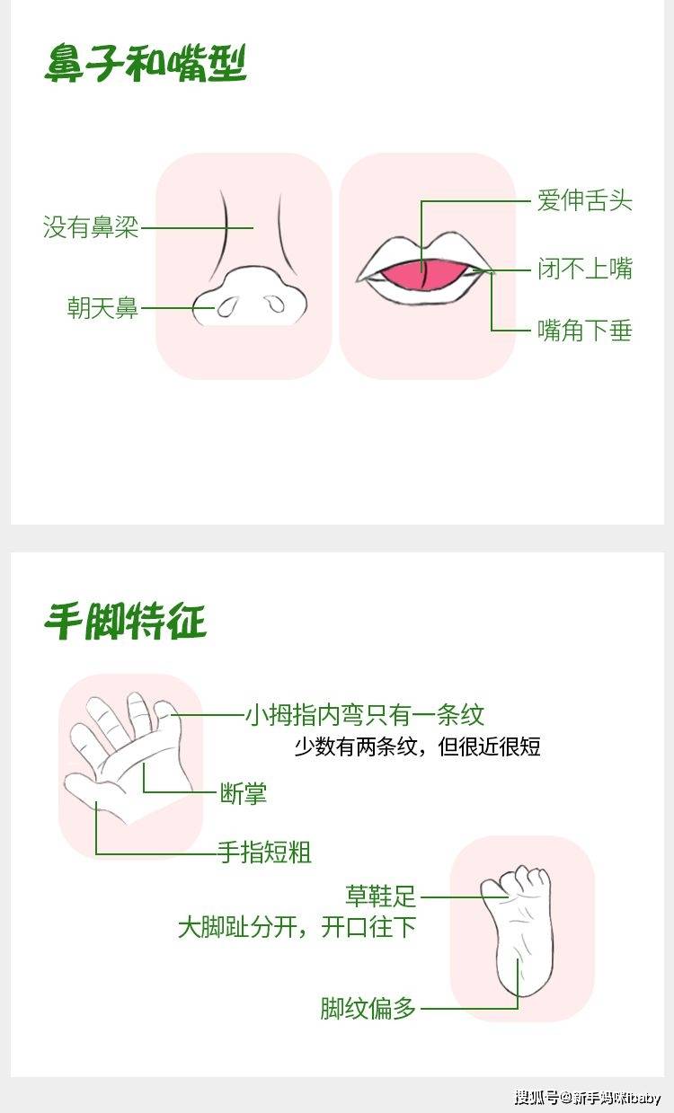 这不是危言耸听,每位准妈妈都有可能生育唐氏儿