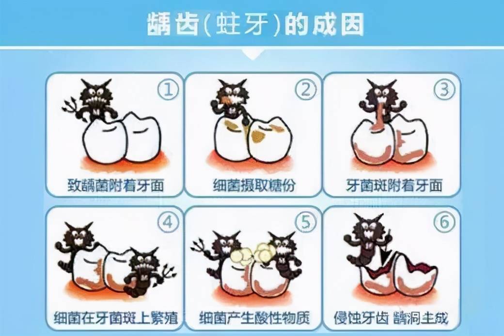 别让一颗蛀牙毁了孩子的形象美国儿科学会教你如何让孩子远离蛀牙