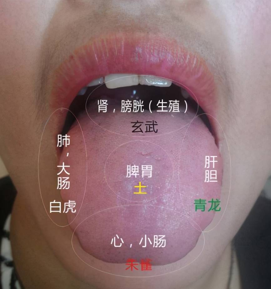 恽铁樵老先生:胃积不是黄苔,亦不可攻下_舌苔