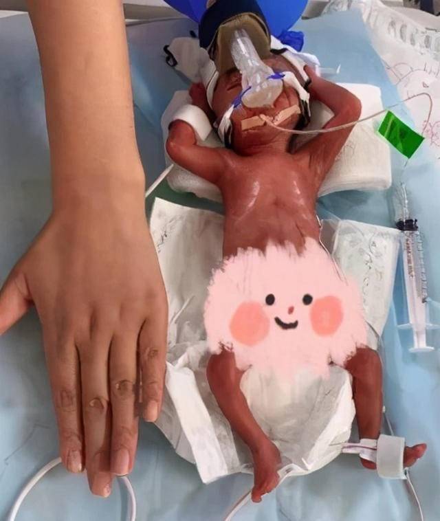 出生小婴儿抢救 23fa0d69b95146a9be067ff0f1f4784a.jpeg