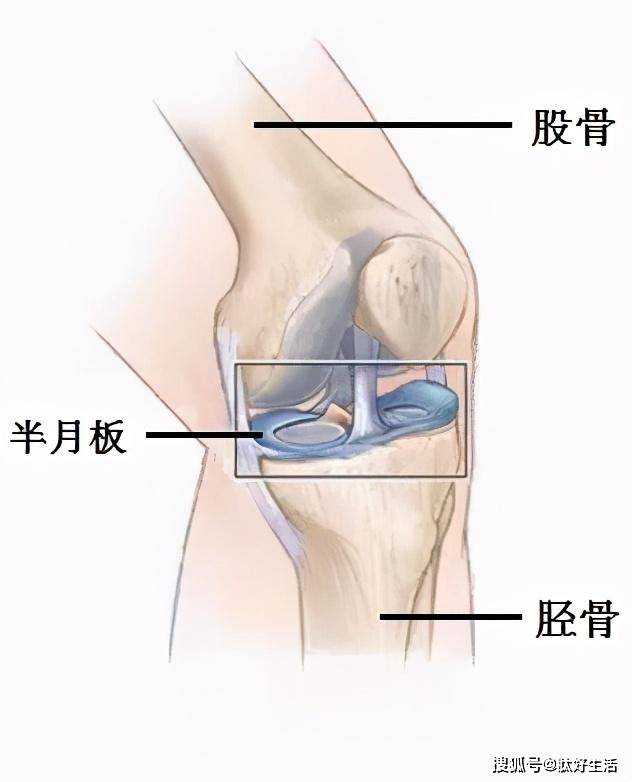 如何判断膝盖半月板损伤?有哪些注意事项?