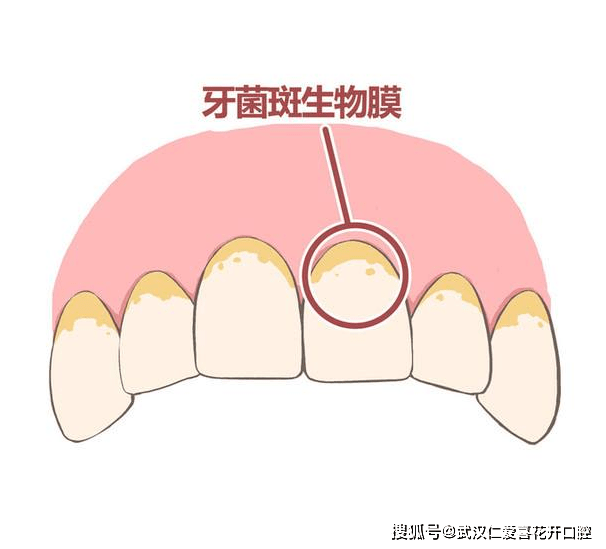 f3987fa729314b31a79ae8c4a2bb59be.png
