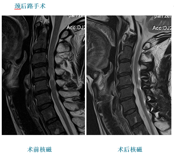 一半脑袋麻木怎么办