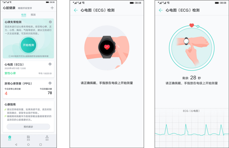 问题|苹果侵犯心电专利，Fitbit硬件出问题，三星、华为一波三折，ECG 手表怎么了？