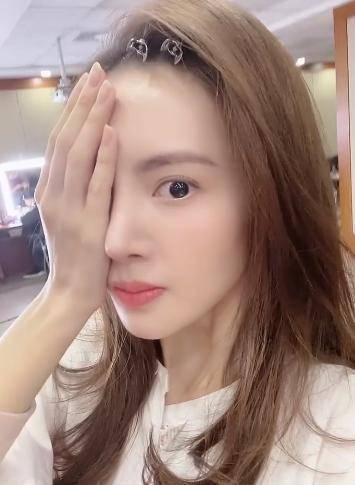 金晨继嘴歪后因鼻子太尖被疑整容，本尊回应：
