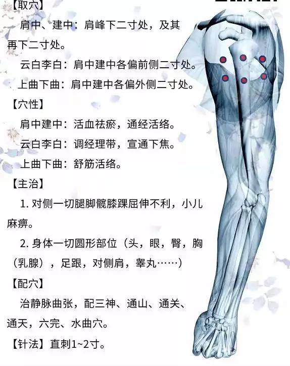 董氏奇穴针灸——多囊卵巢综合症处方