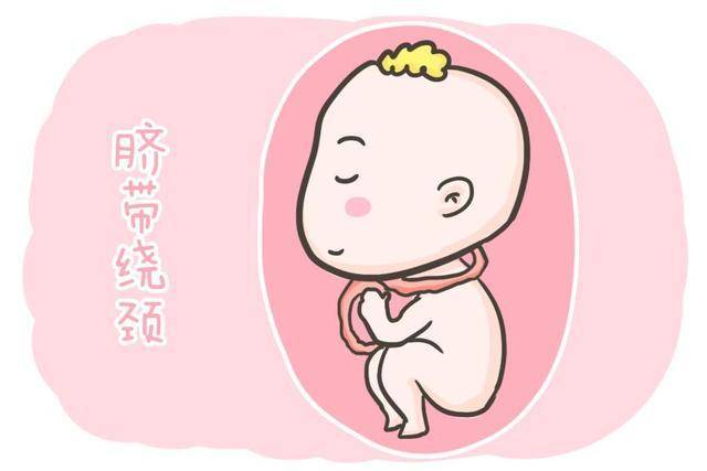 原胎宝“脐带绕颈”不是准妈妈经常摸肚子造成的。不要再相信谣言了