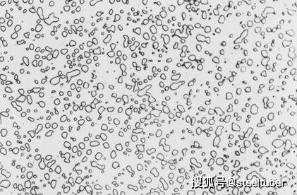 球状珠光体,经球化退火获得,渗碳体成球粒状分布在铁素体基体上;渗碳