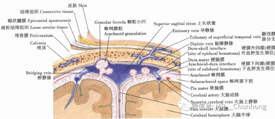 硬膜外与硬膜下出血的血来自哪里