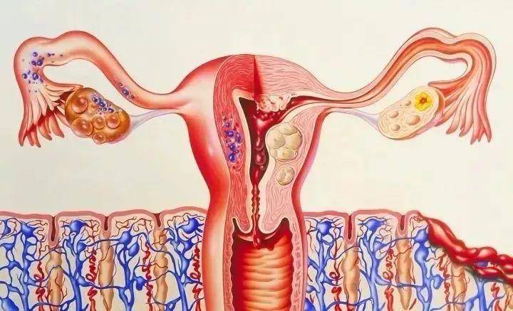 子宫内膜增生是怎么回事?有哪些危害?_月经