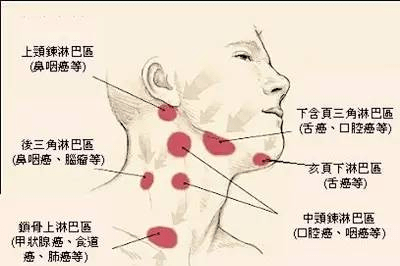 身体有癌颈部先知癌症来访前颈部这两个特征会提醒你
