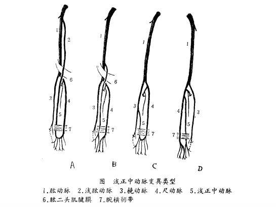 常用人口口径_人口普查(3)