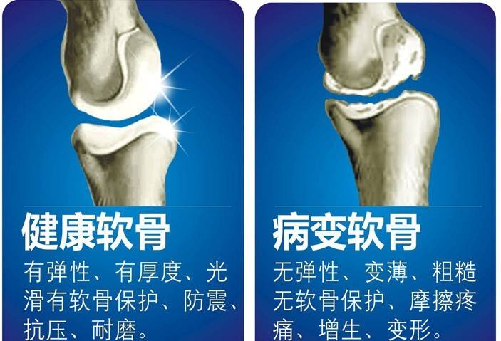 做什么减肥运动不会伤到膝盖半月板 1a4a8ca3f869461fa6c35d84bdc62bb4.jpeg