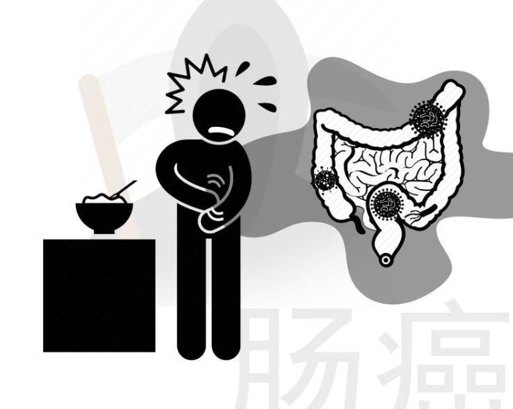 大便若有4种异常,多半是被直肠癌缠上了!