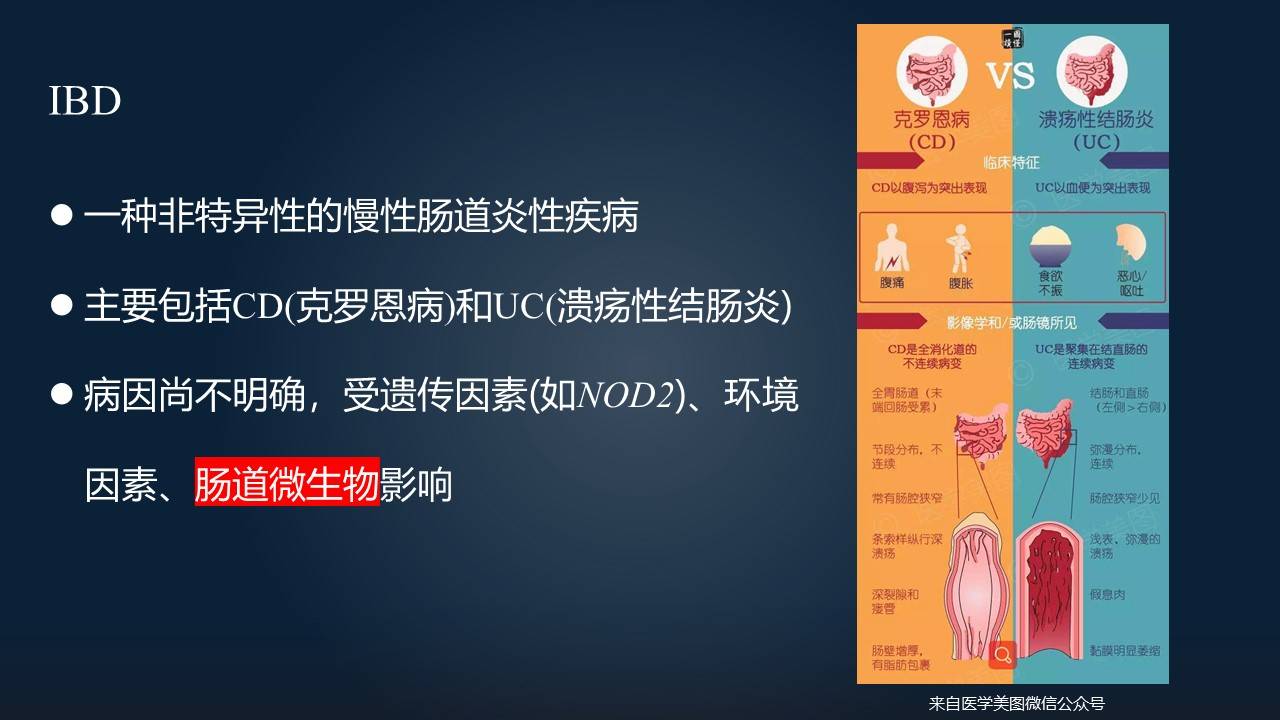 【图文实录】刘胜:19分钟详述炎症性肠病与肠道菌群