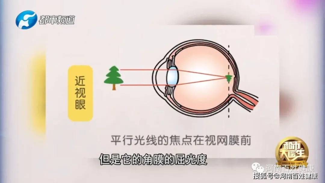 《寒假孩子近视度数咋样才能零增长》河南广播电视台都市大医生1月28