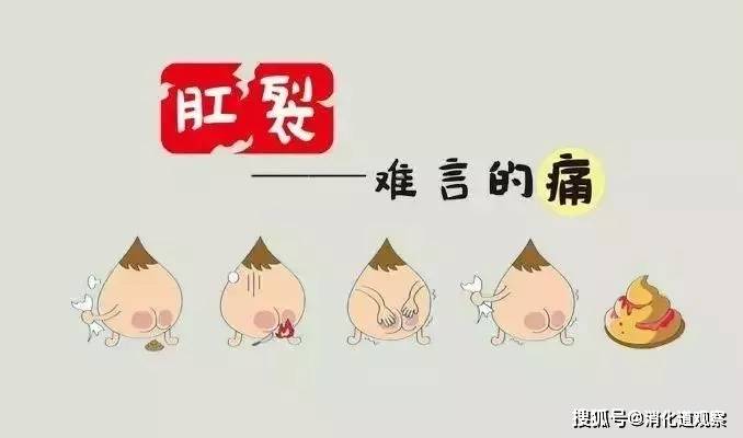 周期性疼痛,便血,便秘 5,肛裂出血的表现是什么?