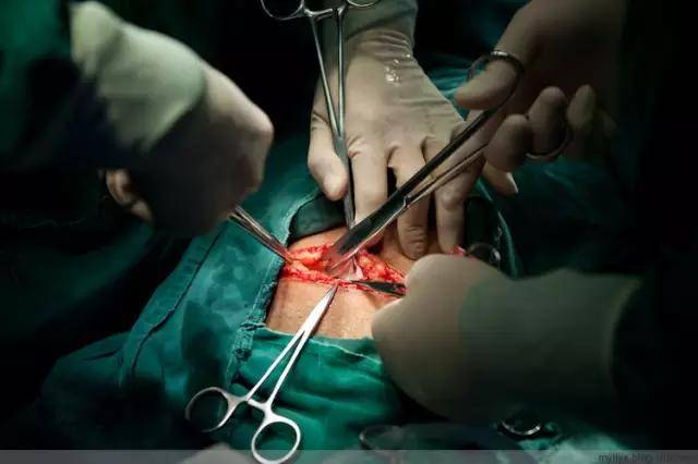 100张高清照片,带你围观最真实的剖腹产手术!