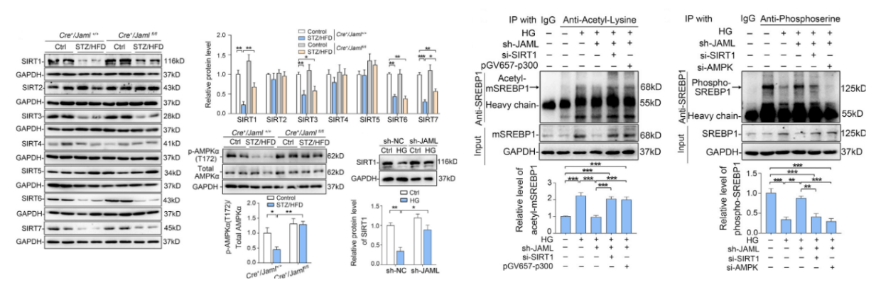 jaml通过sirt1介导的srebp1信号通路调控足细胞脂质代谢最后,在阿霉素