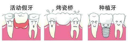 磨损健康牙齿,咀嚼力度不如真牙.