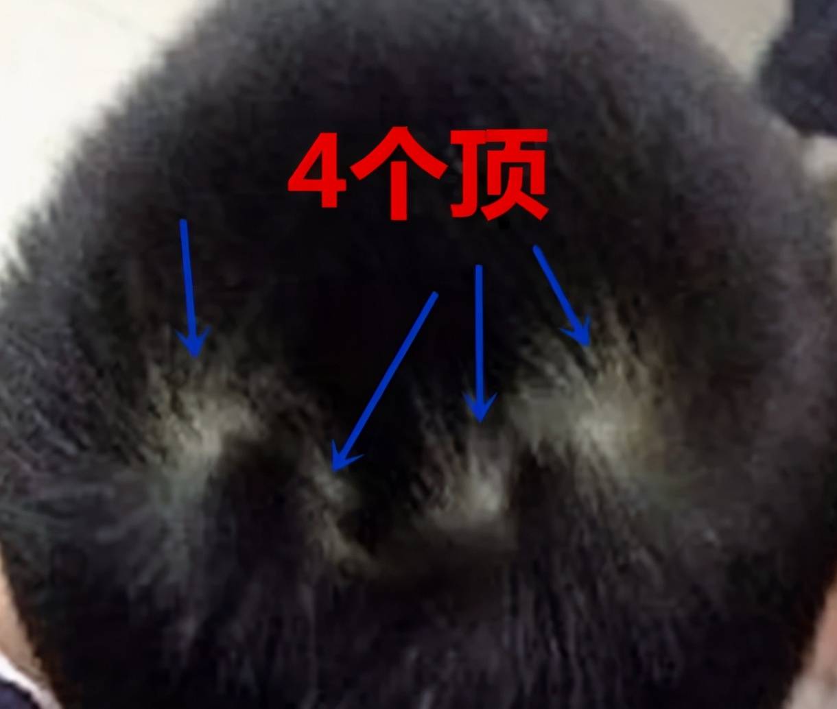头顶一个旋和两个旋的孩子有何区别?科学解释来了,家长别无知