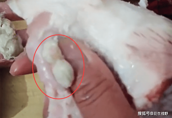 河南一女子从猪肉里挤出白色物体,膏状易沾手,疑似脓包