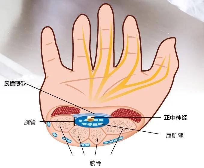 伤不起的鼠标手你中招了么