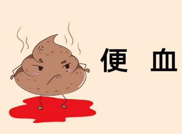 大便出现以下四种异常,则可能是肠道恶变的表现