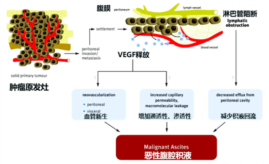 先声药业恩度联合顺铂治疗胸腹腔积液iii期临床试验申请获cde批准